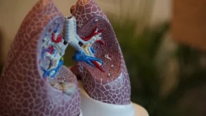 beyond-the-surface-breakthrough-cambridge-study-unveils-hidden-complexity-in-severe-pneumonia