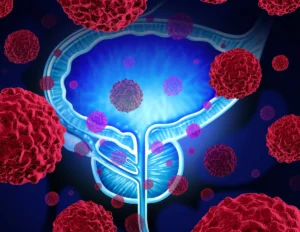 breakthrough-in-bladder-cancer-engineering-a-new-future-for-organ-sparing-immunotherapy