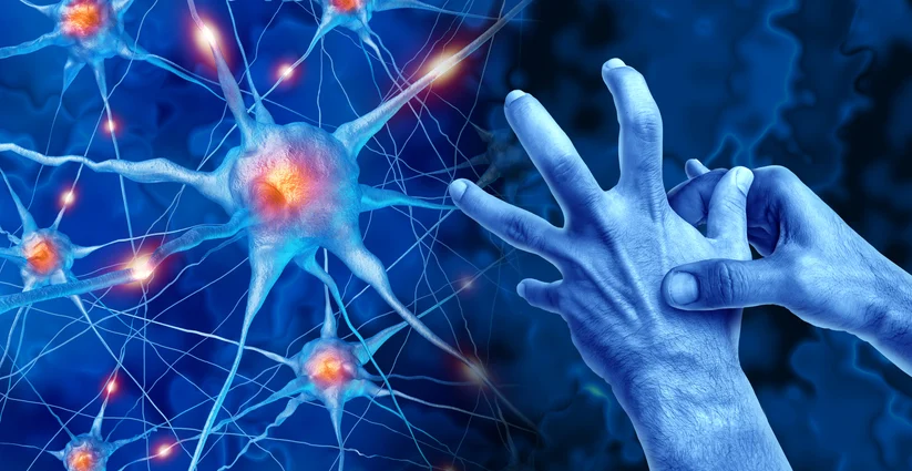 a-new-dawn-for-parkinsons-treatment-landmark-stem-pd-trial-shows-promise-in-regenerative-medicine
