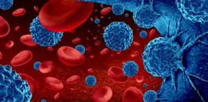 ai-driven-breakthrough-new-bone-marrow-imaging-tool-promises-to-transform-myelodysplastic-neoplasms-diagnosis