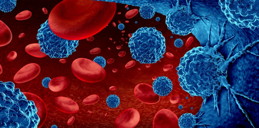 ai-driven-breakthrough-new-bone-marrow-imaging-tool-promises-to-transform-myelodysplastic-neoplasms-diagnosis