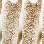 mapping-the-skeletal-blueprint-a-new-frontier-in-bone-regeneration-and-disease-therapy