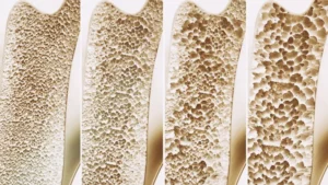 mapping-the-skeletal-blueprint-a-new-frontier-in-bone-regeneration-and-disease-therapy