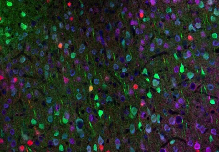 rewiring-the-diseased-brain-new-breakthrough-in-huntingtons-disease-research