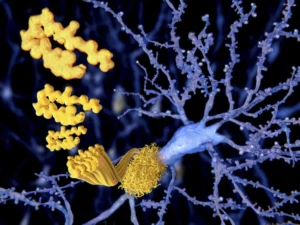the-sorla-shield-a-new-frontier-in-combating-tau-driven-neurodegeneration