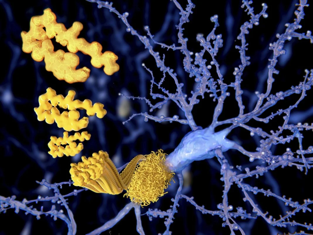 the-sorla-shield-a-new-frontier-in-combating-tau-driven-neurodegeneration