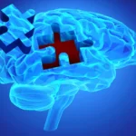 A New Frontier in Alzheimer’s: Blocking Immune Infiltration to Prevent Neurodegeneration