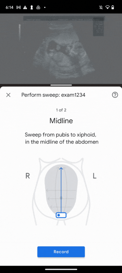 ai-powered-ultrasound-how-google-research-and-tensorflow-lite-are-expanding-global-access-to-maternal-healthcare
