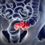 ai-driven-breakthrough-new-roadmap-emerges-for-treating-hard-to-beat-colorectal-cancer